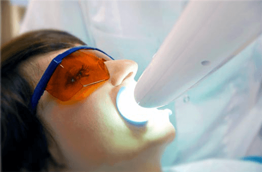 Understanding the Causes of Teeth Sensitivity Royal Leamington Spa