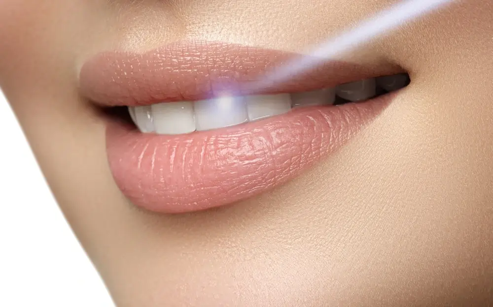 A Smarter Alternative: At-Home Laser Teeth Whitening Royal Leamington Spa