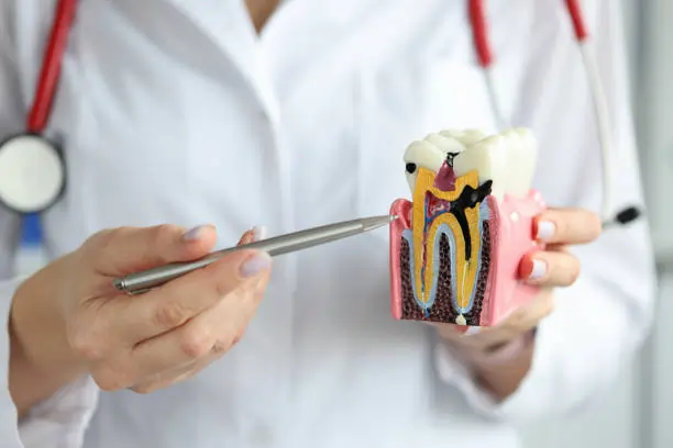 The Silent Culprits: Common Habits That Damage Your Teeth Royal Leamington Spa