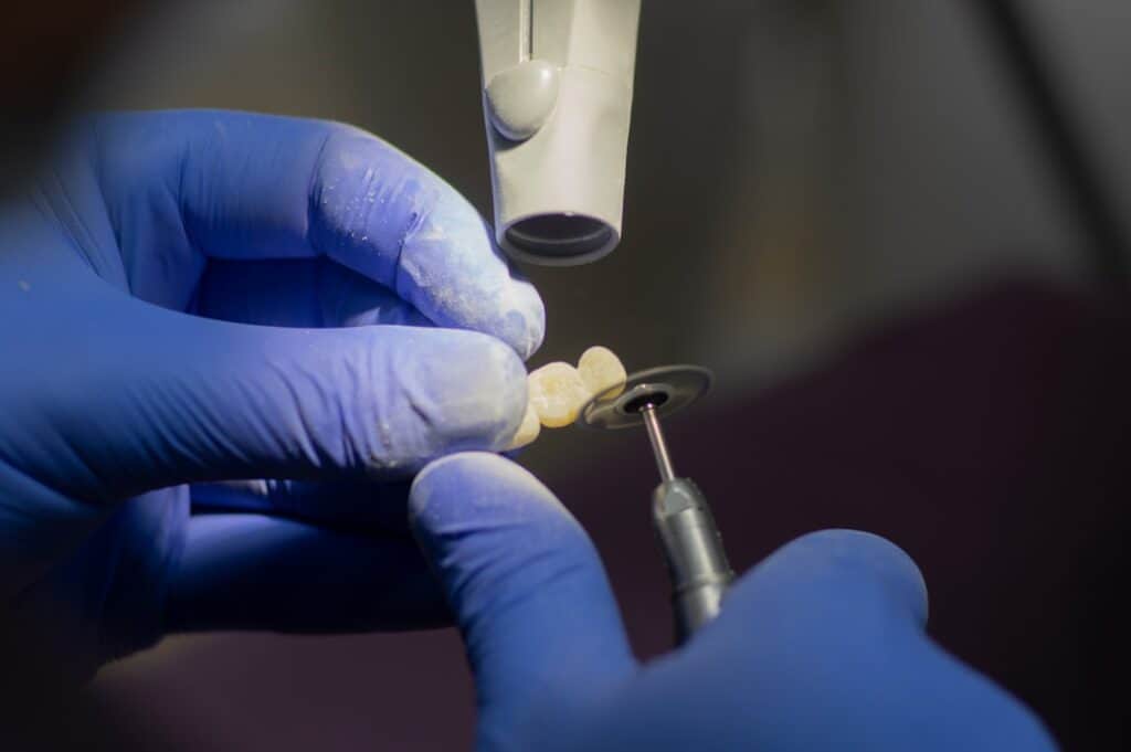Customised Dental Solutions: Crowns, Aligners, and Implants Royal Leamington Spa