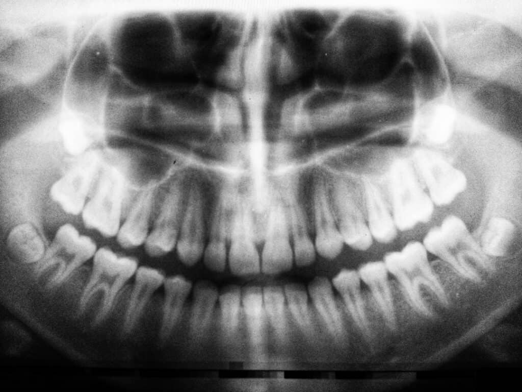 The Future of 3D Printing in Oral Healthcare Royal Leamington Spa